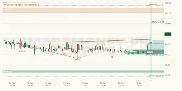 SZTM chart