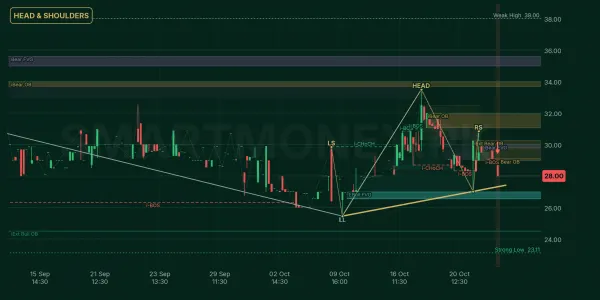 RUPL chart