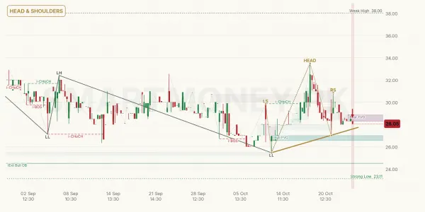 RUPL chart