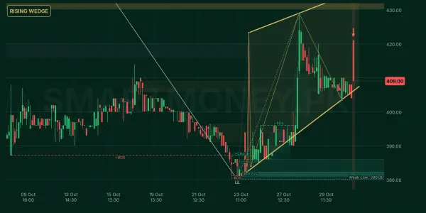 SSOM chart
