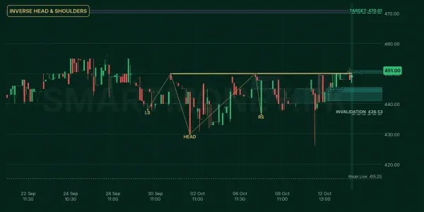 SHFA chart