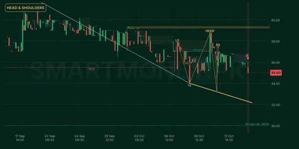 SERT chart