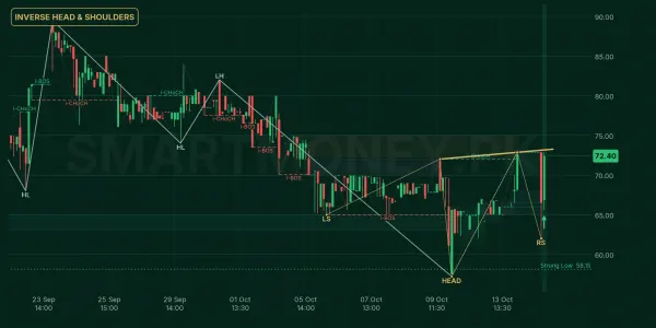 OML chart